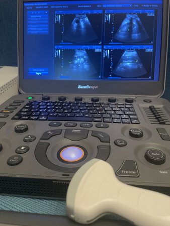 УЗИ сканер Sonoscape S2N - современные возможности ультрасонографии